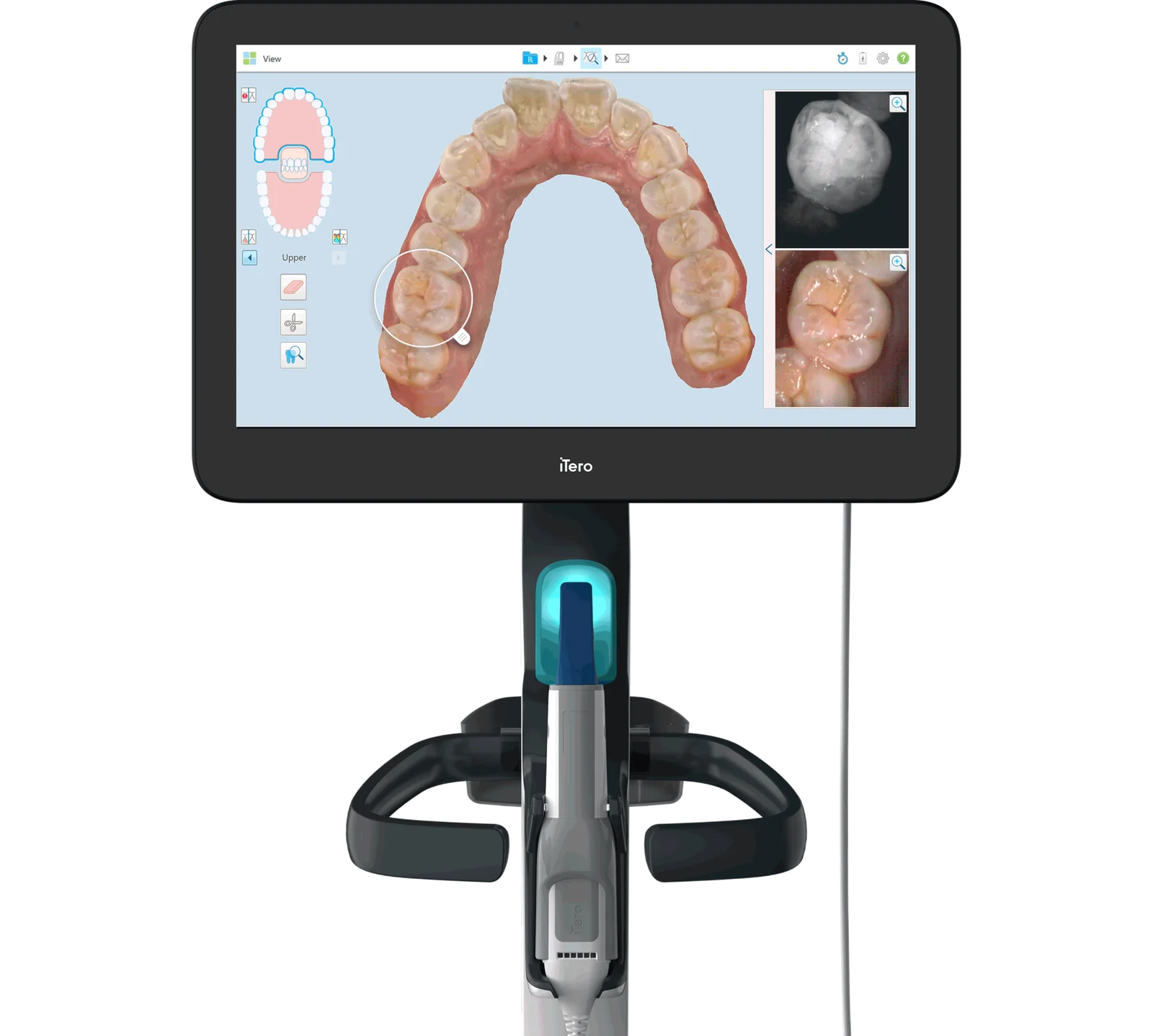 Itero invisalign kolkata