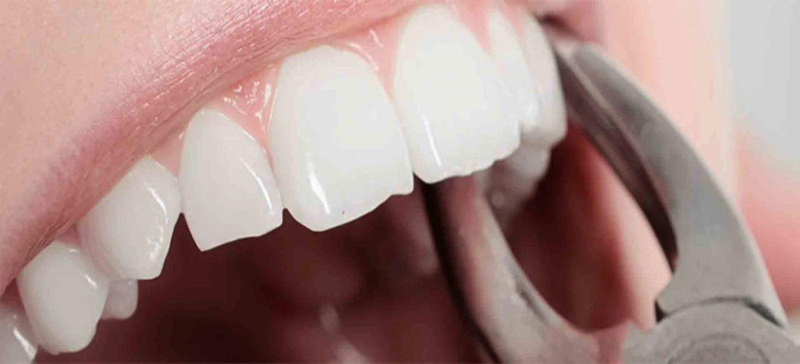 oral surgery tre